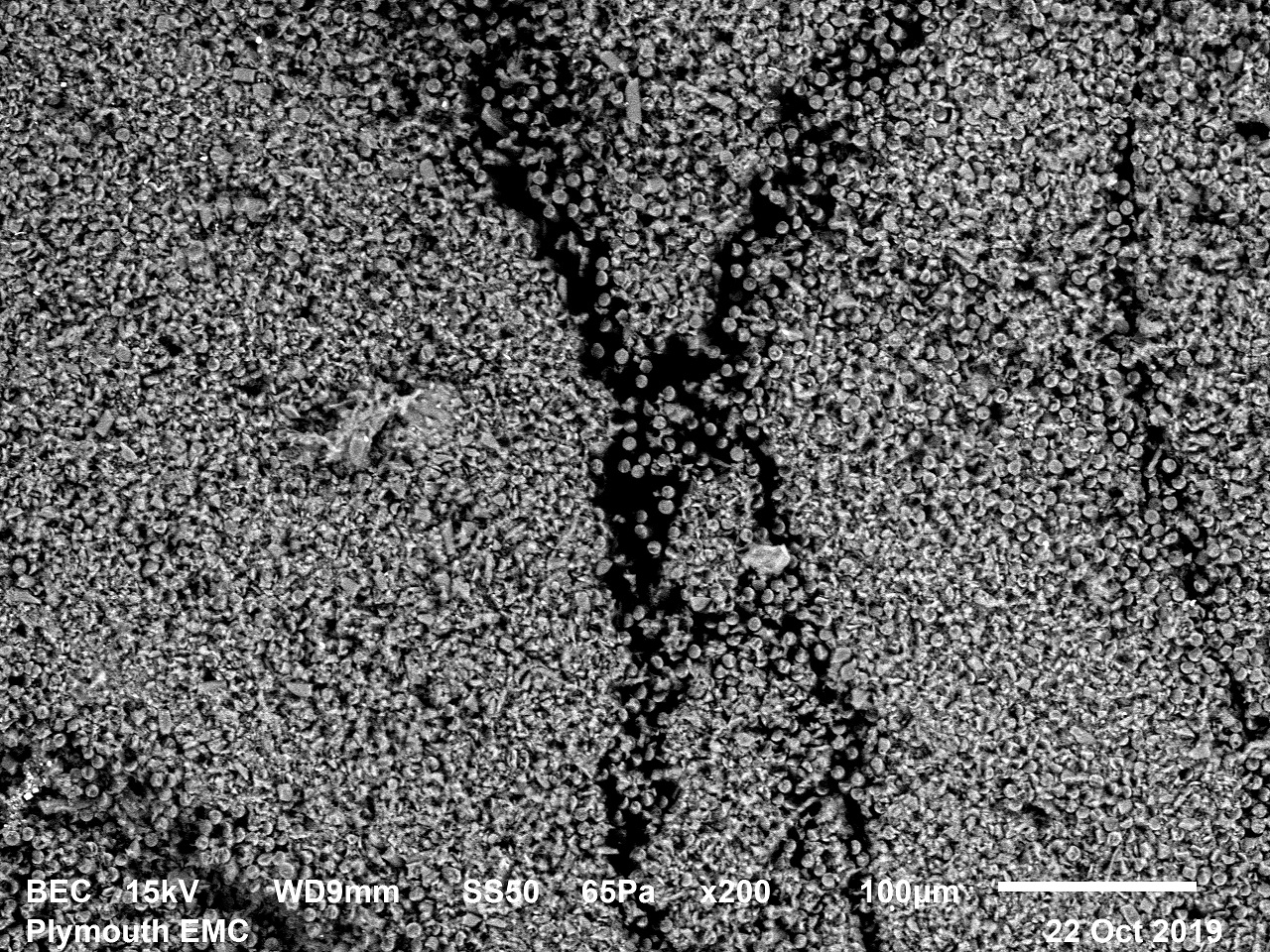 electron micrograph
